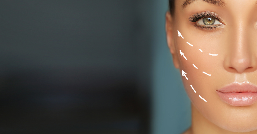 Com o passar do tempo, nossa pele perde naturalmente o ácido hialurônico, o que pode levar ao aparecimento de rugas e linhas finas.